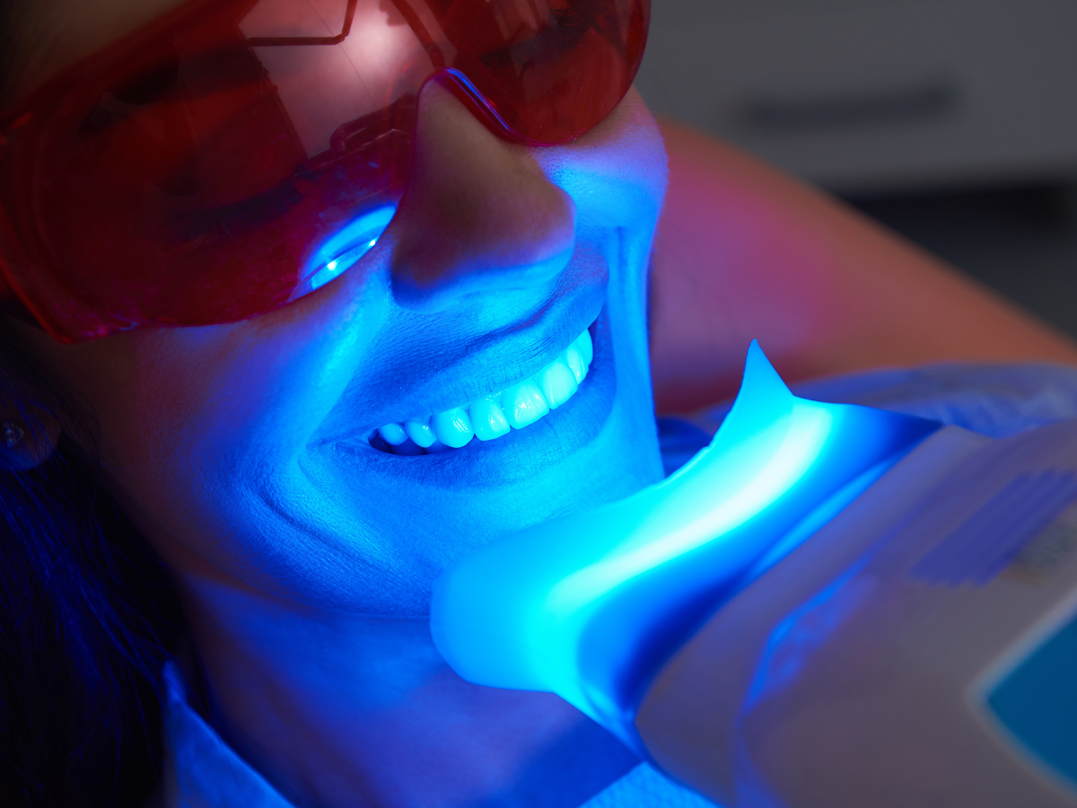 Teeth whitening treatment at a dental clinic in Jayanagar for a brighter, whiter smile