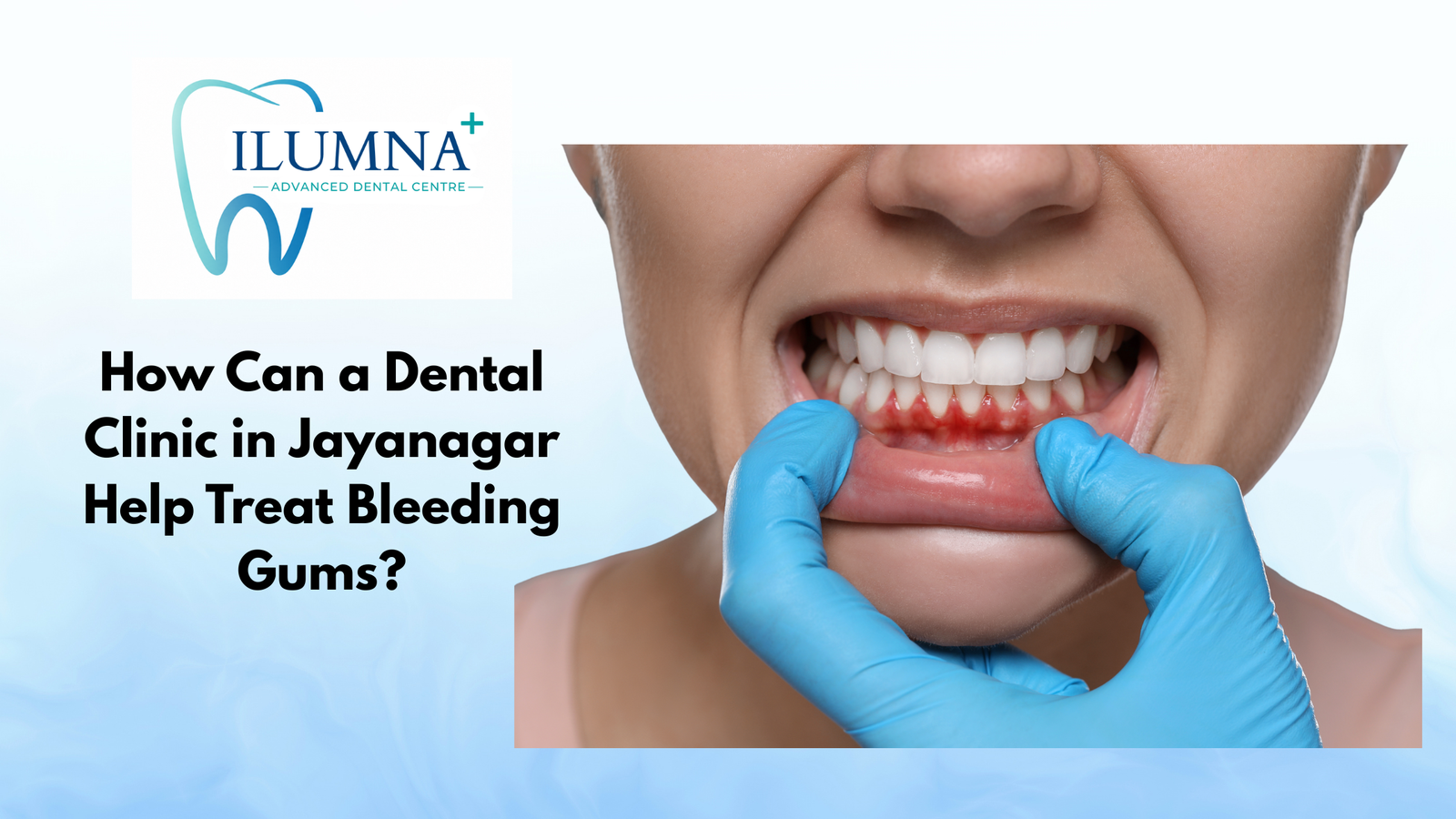 Dental examination of bleeding gums at a dental clinic in Jayanagar for gum health treatment