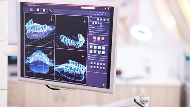 Digital teeth scan for Invisalign treatment at a dental clinic in Jayanagar