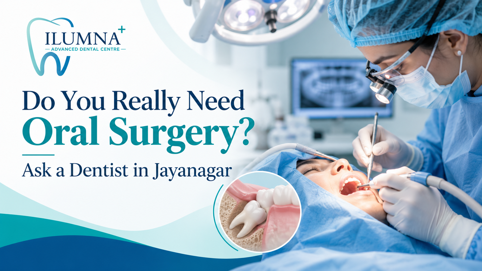 Oral surgery procedure performed by a dentist in Jayanagar at iLUMNA Dental