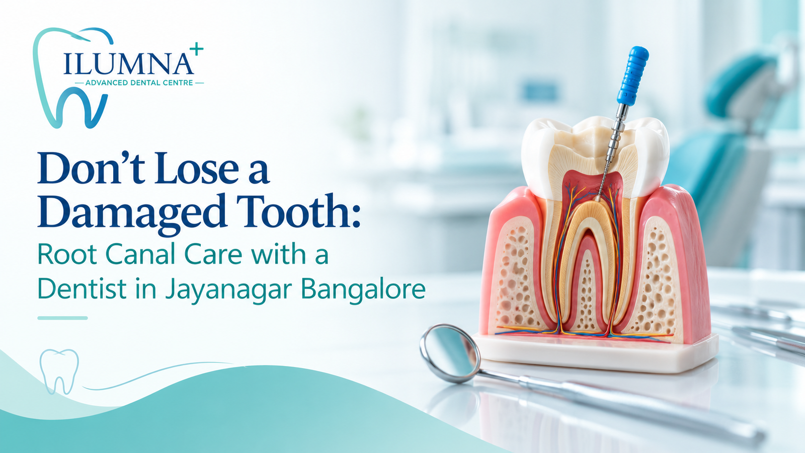 **Alt text:** `Root canal treatment with a dentist in Jayanagar Bangalore for preserving a damaged tooth`