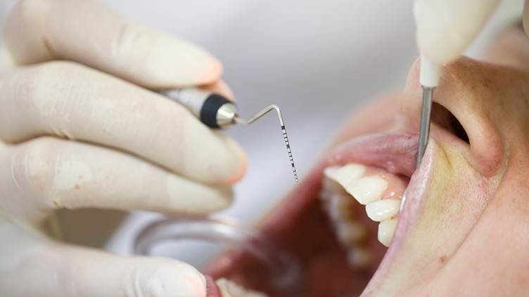 Dentist in Jayanagar examining gums during a periodontal evaluation