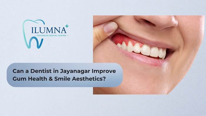 Dentist in Jayanagar examining gums for periodontal health