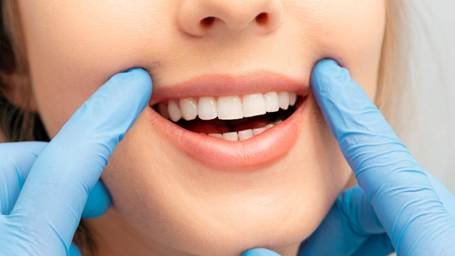 Professional teeth whitening examination showing a dentist checking a patient’s smile with gloved hands at iLUMNA Dental in Jayanagar.